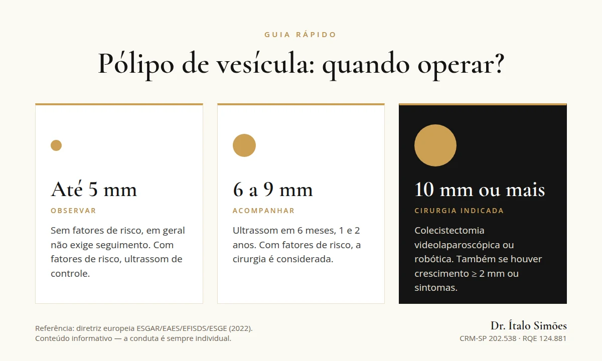 Infográfico: pólipo de vesícula até 5 mm observar, de 6 a 9 mm acompanhar com ultrassom, 10 mm ou mais cirurgia indicada