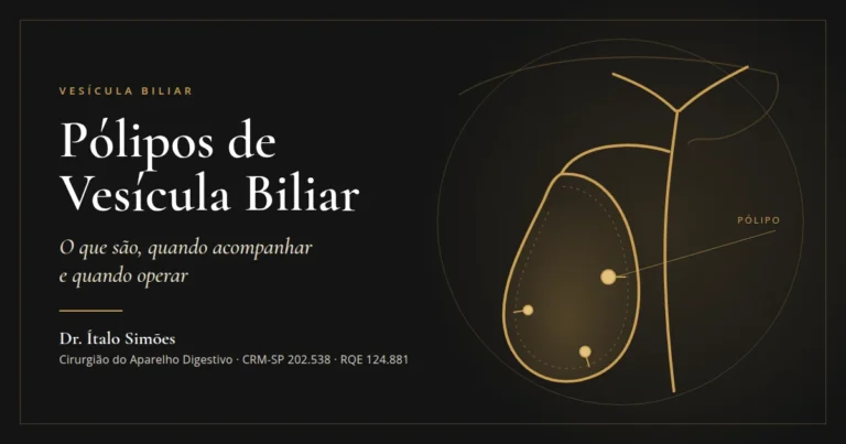 Ilustração da vesícula biliar com pólipos na parede interna — Dr. Ítalo Simões, cirurgião do aparelho digestivo em São Paulo
